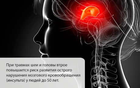 Вероятността за инсулт се повишава през първите месеци след нараняване на главата или шията